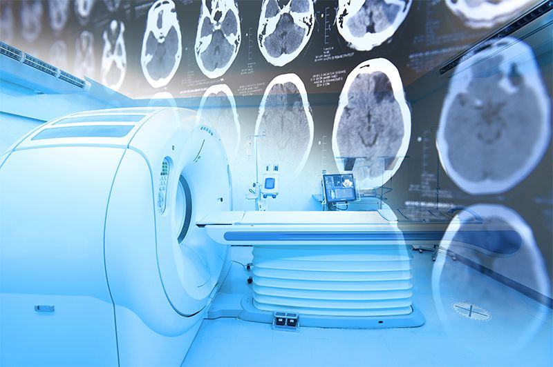 Neuroimaging, Neuroradiology, And MRI Scanner Brain Injury And Concussion Attorneys Denver Colorado.