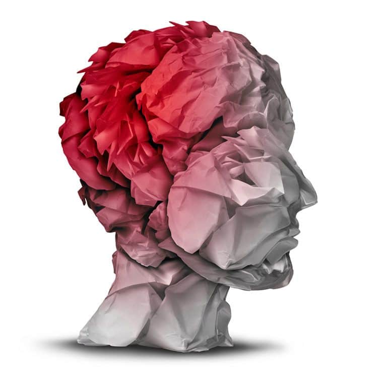 What Is A MTBI Or Mild Traumatic Brain Injury.