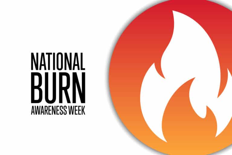 Prevent Burn Injuries